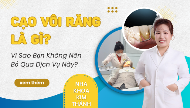 cao-voi-rang-la-gi-vi-sao-ban-khong-nen-bo-qua-dich-vu-nay
